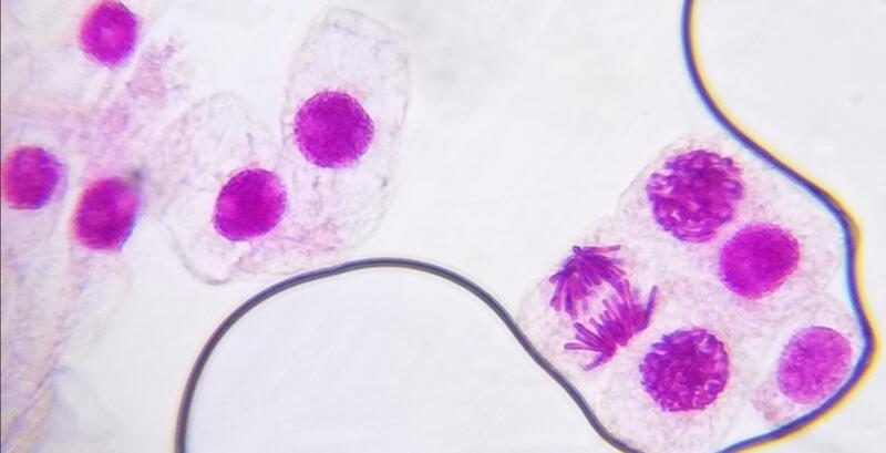 タマネギの体細胞分裂